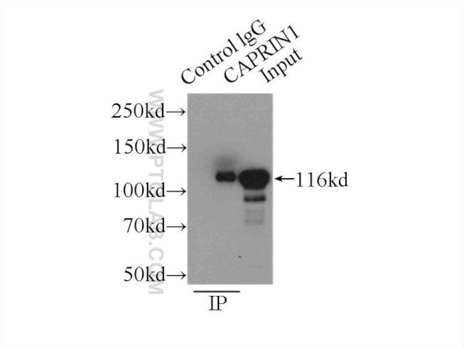 CAPRIN1 Antibody in Immunoprecipitation (IP)