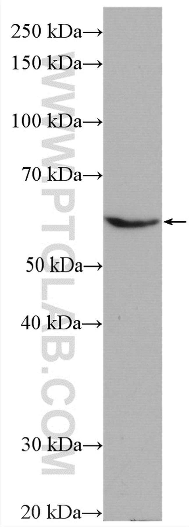 HYAL2 Antibody in Western Blot (WB)