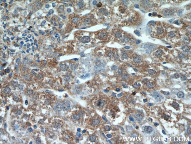 HSD17B4 Antibody in Immunohistochemistry (Paraffin) (IHC (P))