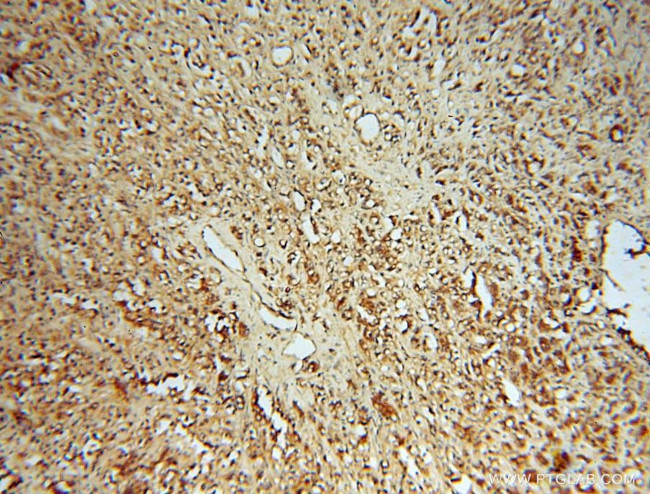 HSD17B4 Antibody in Immunohistochemistry (Paraffin) (IHC (P))