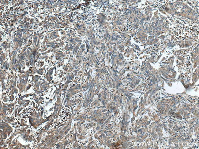 HSD17B4 Antibody in Immunohistochemistry (Paraffin) (IHC (P))