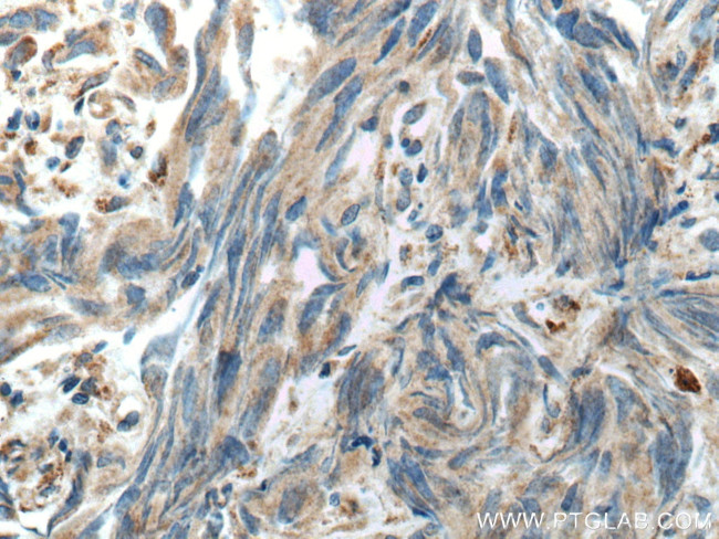 HSD17B4 Antibody in Immunohistochemistry (Paraffin) (IHC (P))