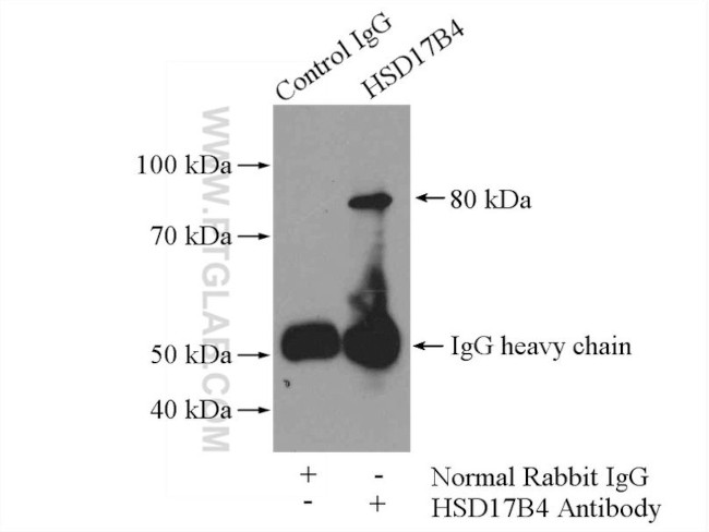 HSD17B4 Antibody in Immunoprecipitation (IP)