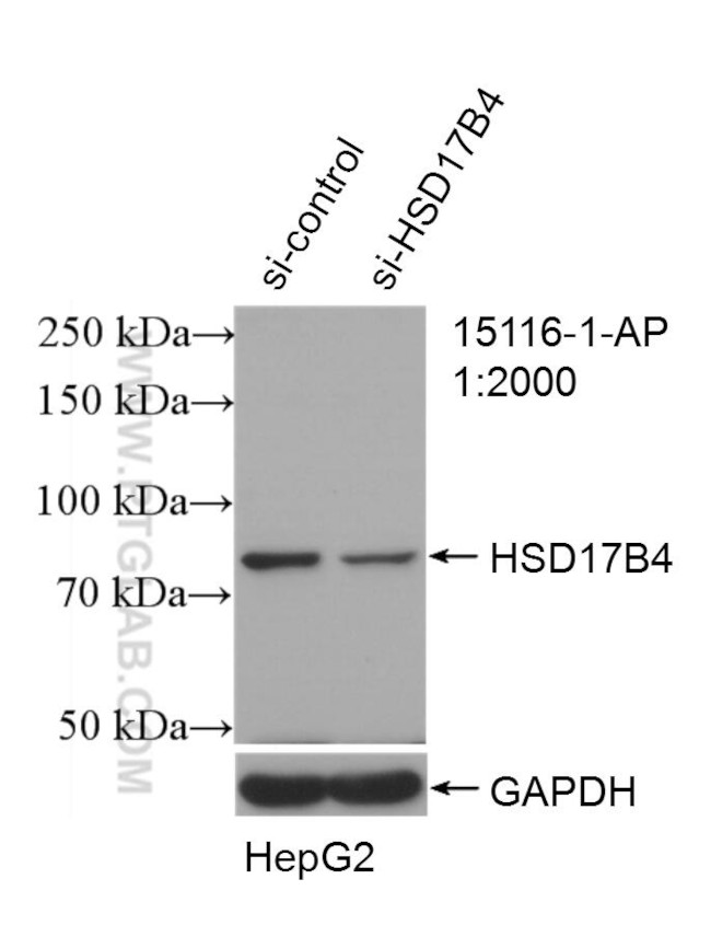 HSD17B4 Antibody in Western Blot (WB)