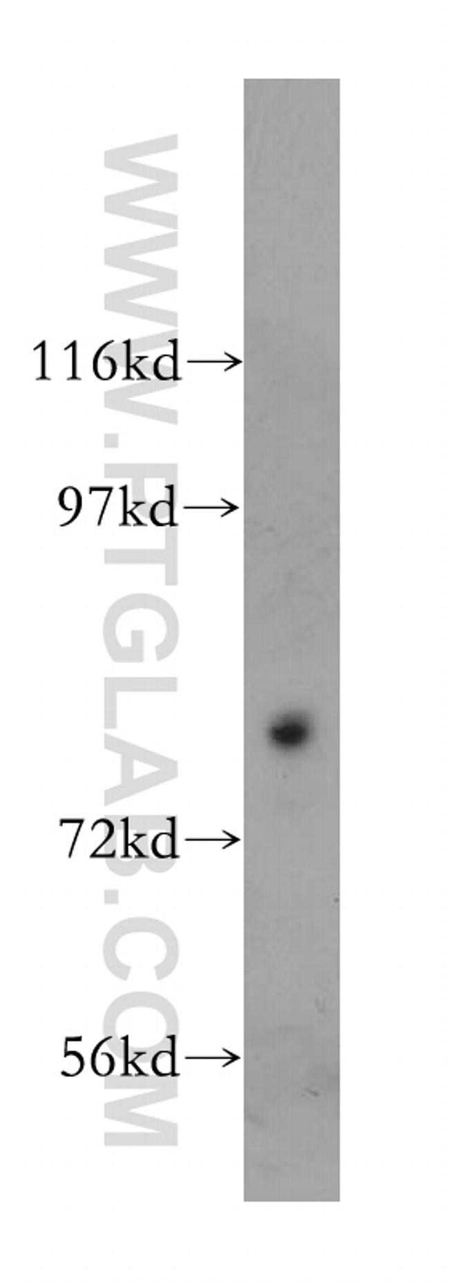 HSD17B4 Antibody in Western Blot (WB)