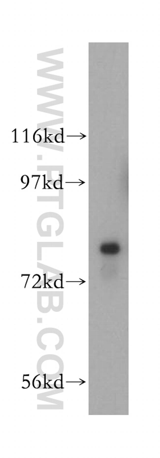 HSD17B4 Antibody in Western Blot (WB)