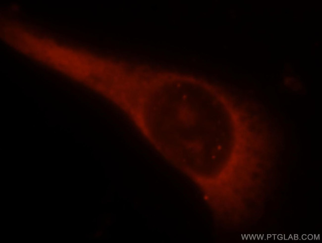 LMOD1 Antibody in Immunocytochemistry (ICC/IF)