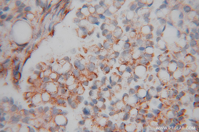 LMOD1 Antibody in Immunohistochemistry (Paraffin) (IHC (P))