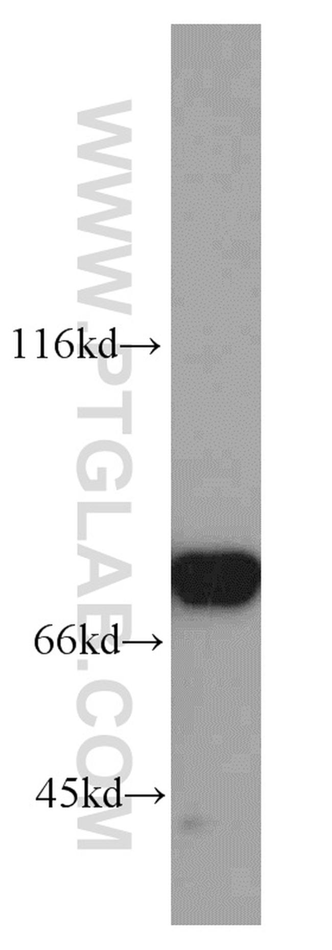 LMOD1 Antibody in Western Blot (WB)