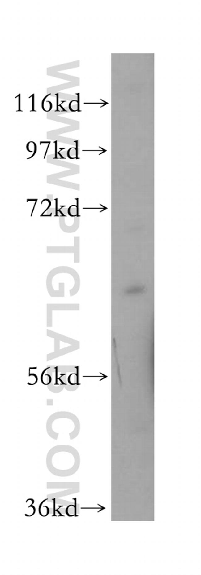 LMOD1 Antibody in Western Blot (WB)