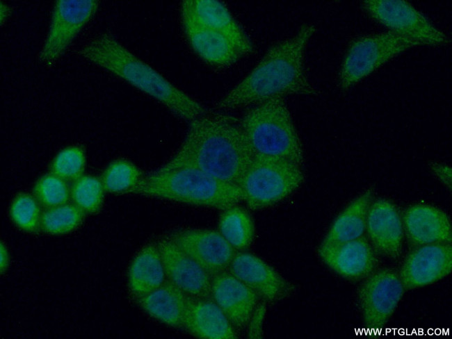 HCCS Antibody in Immunocytochemistry (ICC/IF)