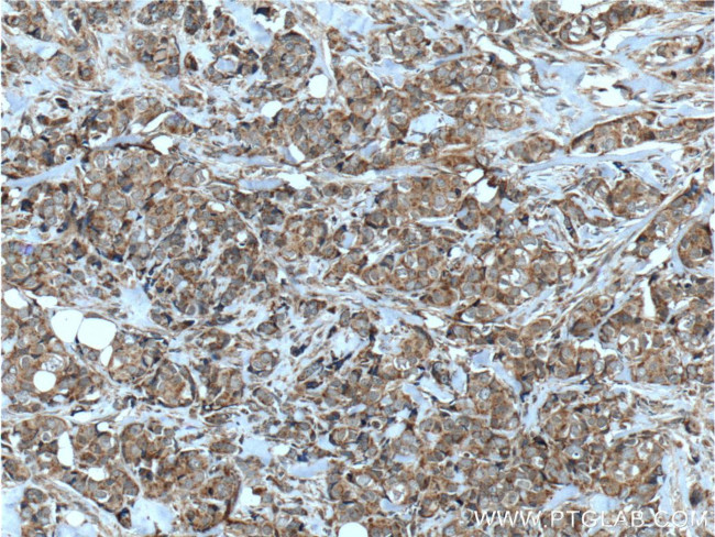 HCCS Antibody in Immunohistochemistry (Paraffin) (IHC (P))