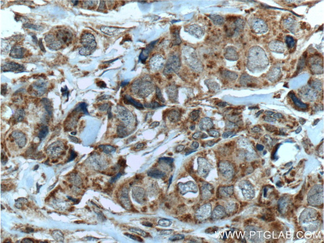 HCCS Antibody in Immunohistochemistry (Paraffin) (IHC (P))