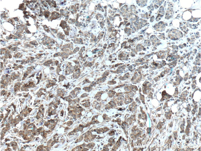 HCCS Antibody in Immunohistochemistry (Paraffin) (IHC (P))