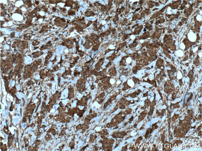 HCCS Antibody in Immunohistochemistry (Paraffin) (IHC (P))