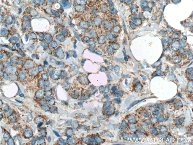 HCCS Antibody in Immunohistochemistry (Paraffin) (IHC (P))