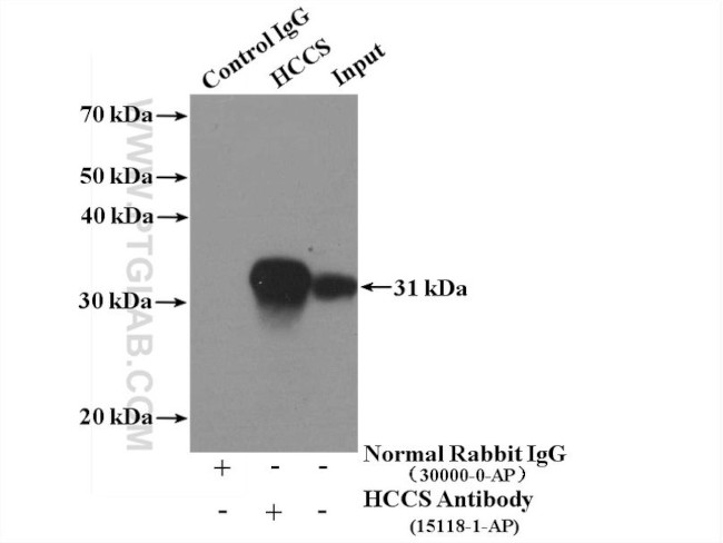 HCCS Antibody in Immunoprecipitation (IP)