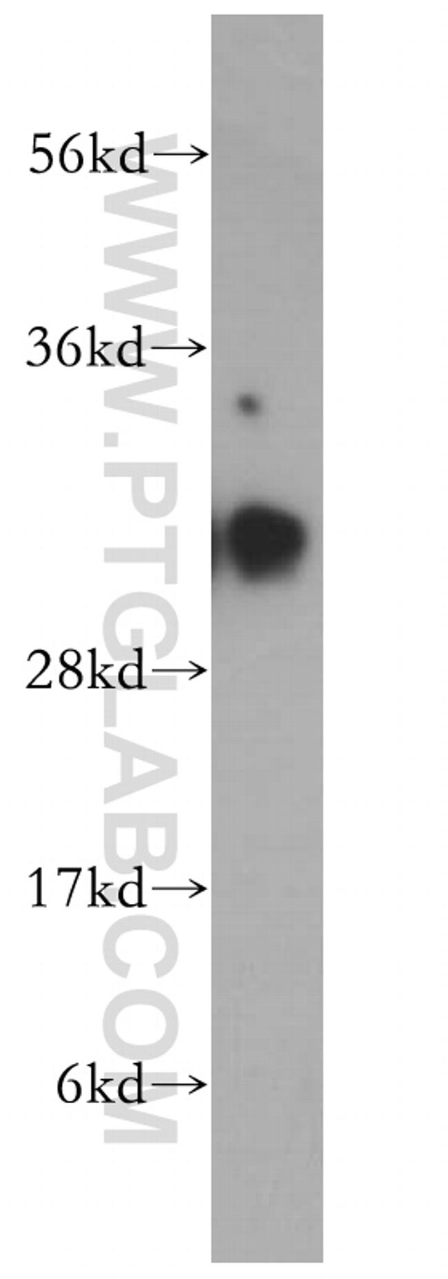 HCCS Antibody in Western Blot (WB)