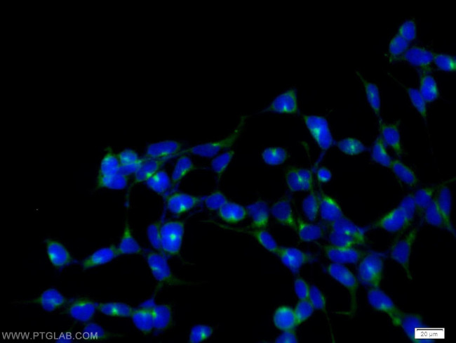 SCAMP2 Antibody in Immunocytochemistry (ICC/IF)