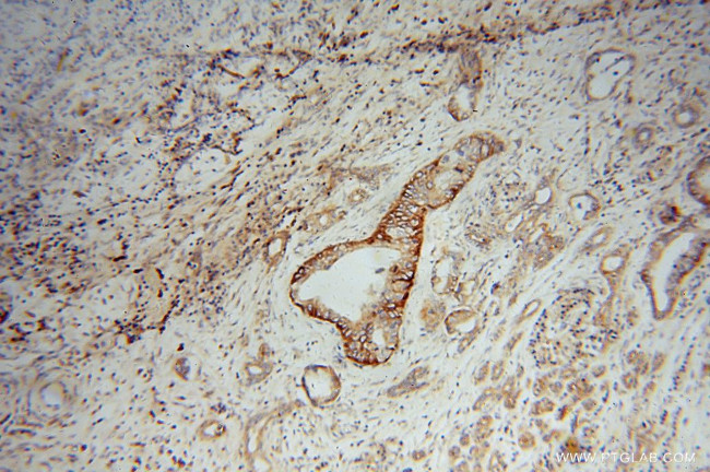 SCAMP2 Antibody in Immunohistochemistry (Paraffin) (IHC (P))