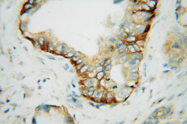 SCAMP2 Antibody in Immunohistochemistry (Paraffin) (IHC (P))