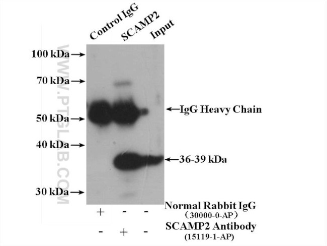 SCAMP2 Antibody in Immunoprecipitation (IP)