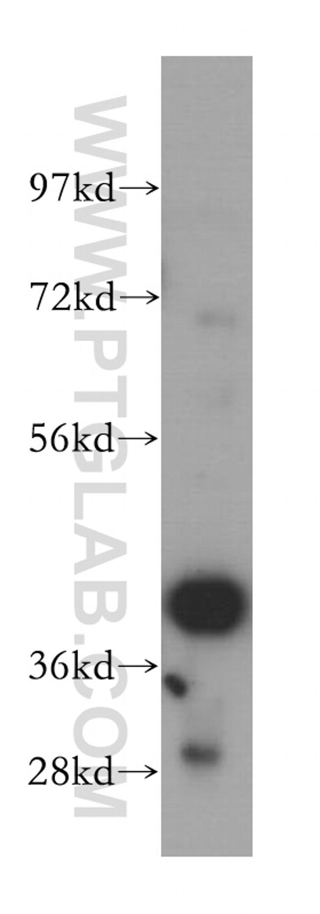 SCAMP2 Antibody in Western Blot (WB)