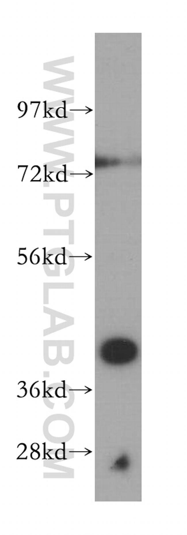 SCAMP2 Antibody in Western Blot (WB)