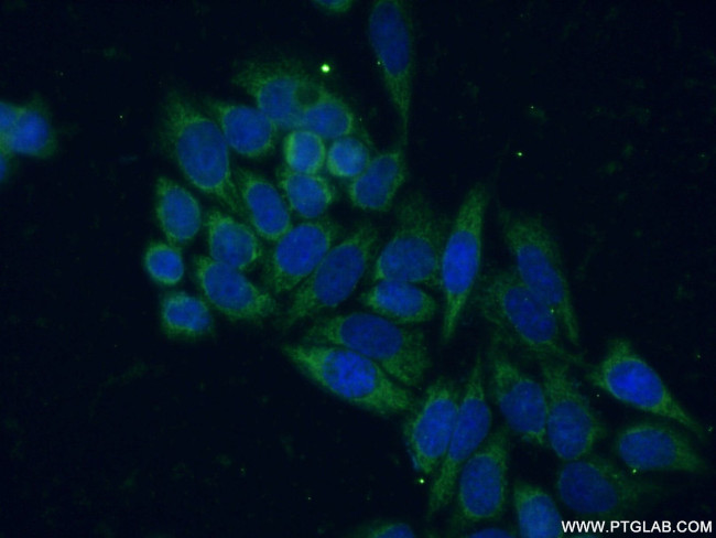 SIRT5 Antibody in Immunocytochemistry (ICC/IF)