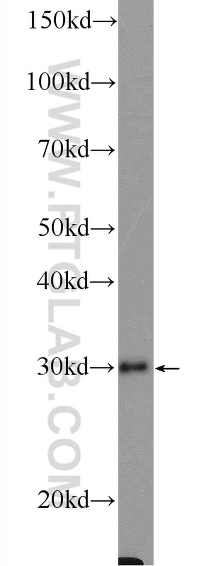 SIRT5 Antibody in Western Blot (WB)