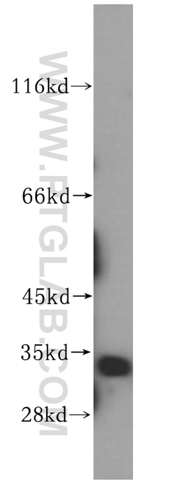 SIRT5 Antibody in Western Blot (WB)