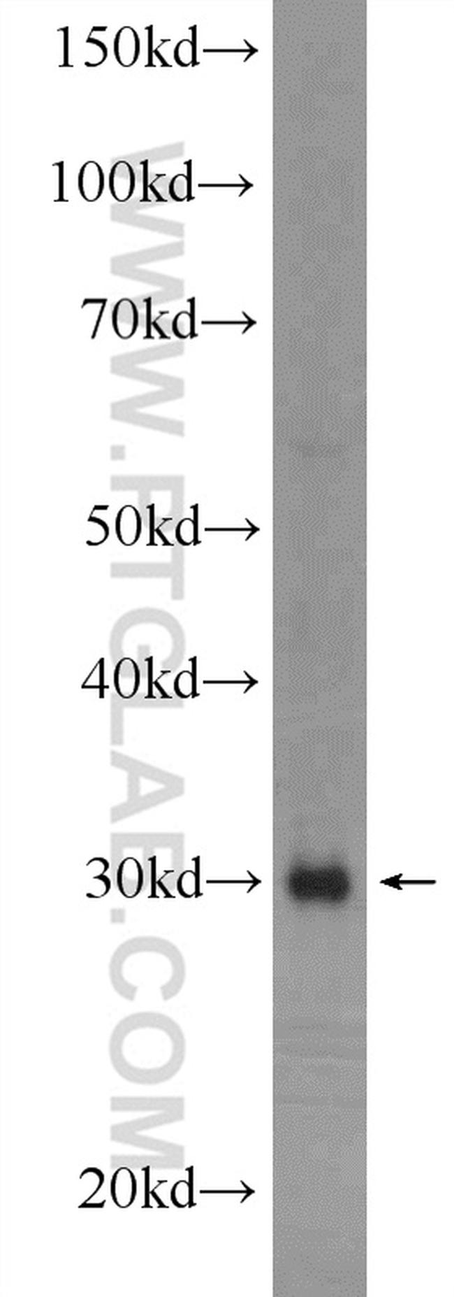 SIRT5 Antibody in Western Blot (WB)