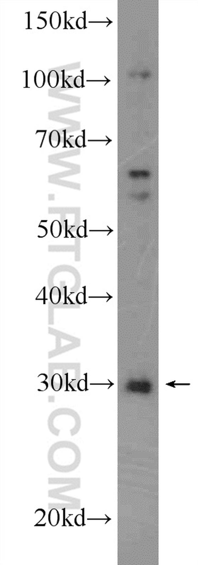 SIRT5 Antibody in Western Blot (WB)