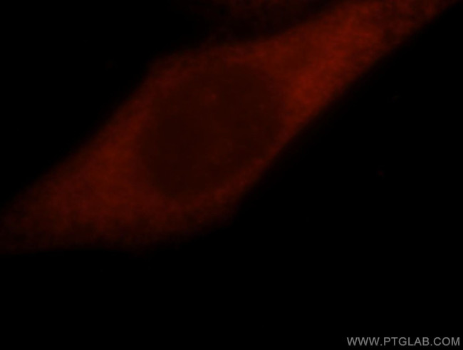 GSTO1 Antibody in Immunocytochemistry (ICC/IF)