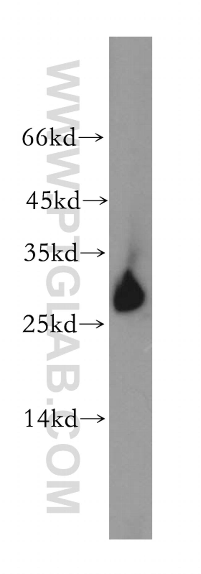 GSTO1 Antibody in Western Blot (WB)