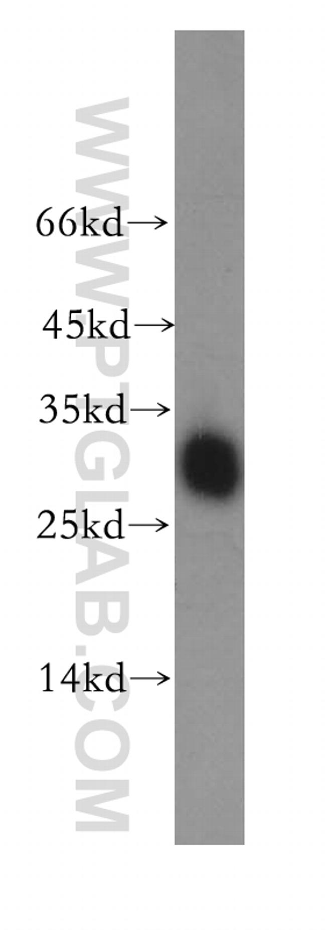 GSTO1 Antibody in Western Blot (WB)