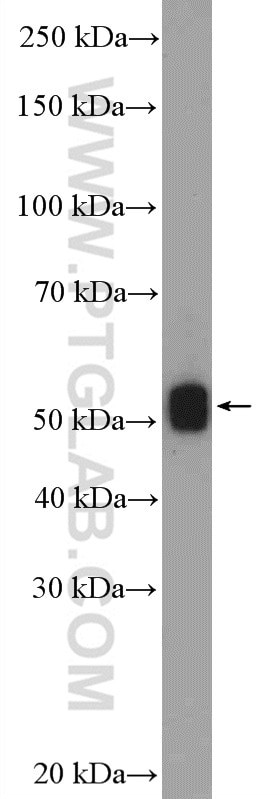 OGG1 Antibody in Western Blot (WB)