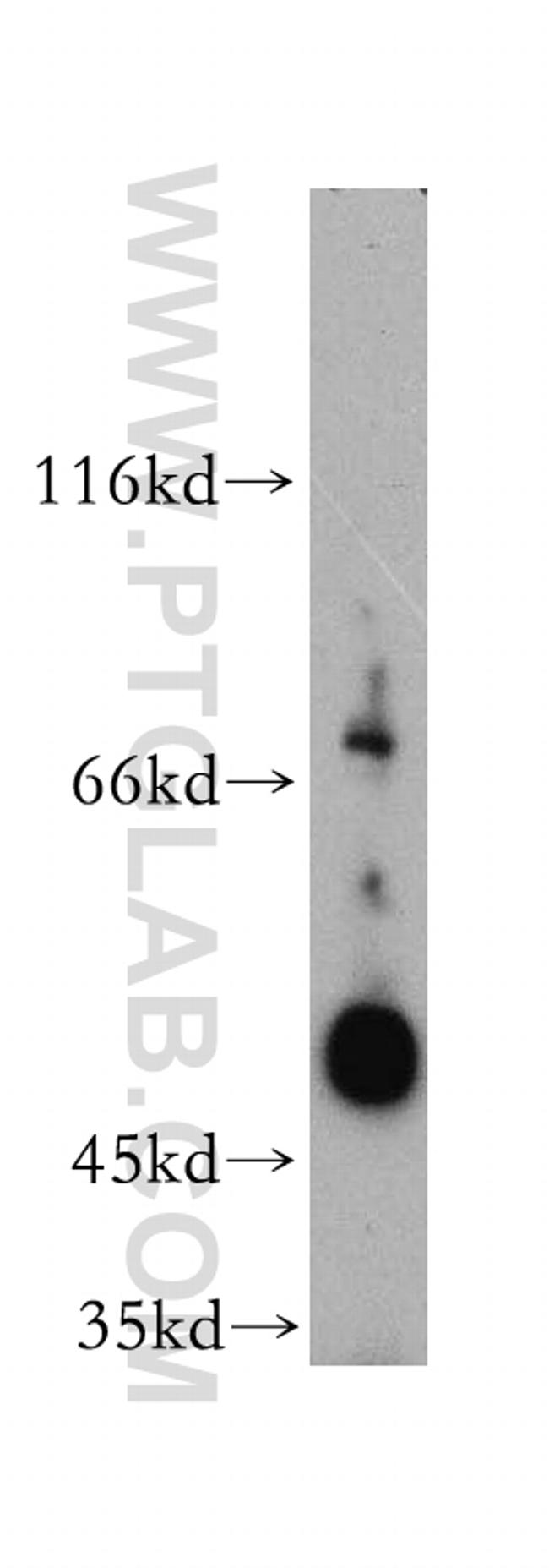 OGG1 Antibody in Western Blot (WB)