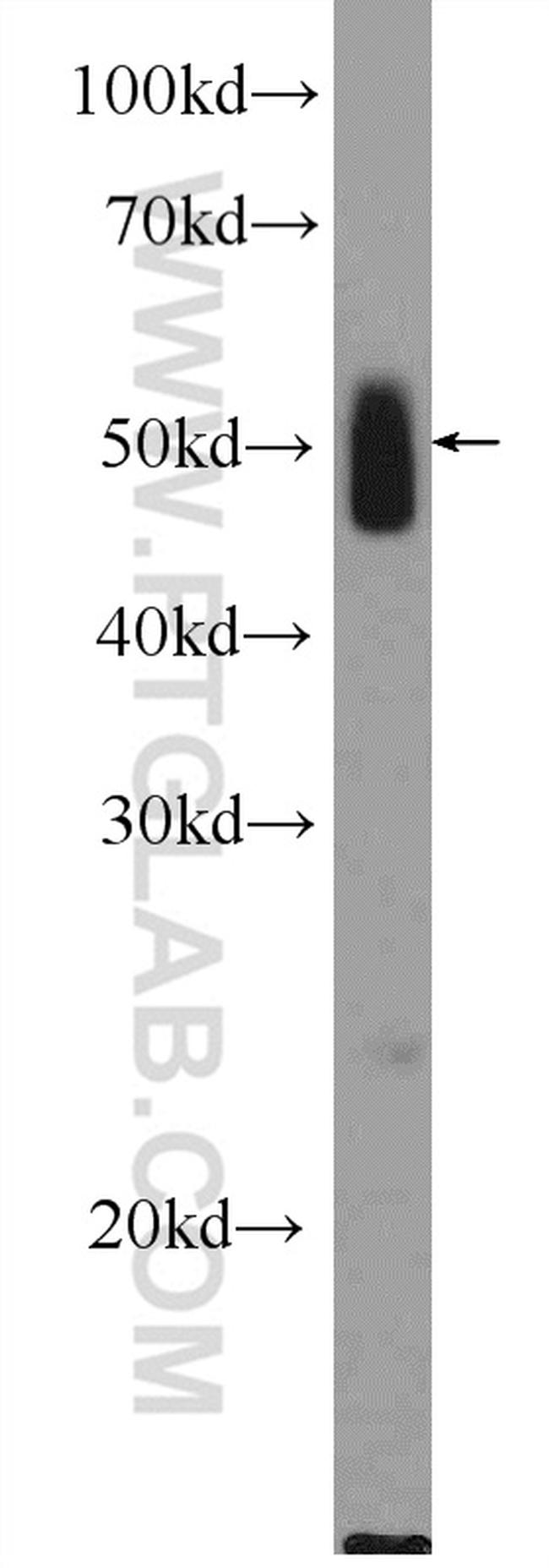 OGG1 Antibody in Western Blot (WB)