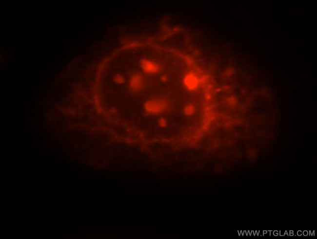 ALADIN Antibody in Immunocytochemistry (ICC/IF)