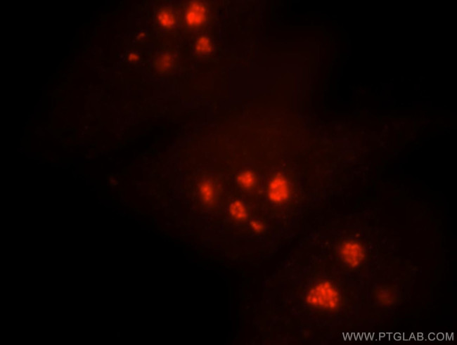 NHP2 Antibody in Immunocytochemistry (ICC/IF)