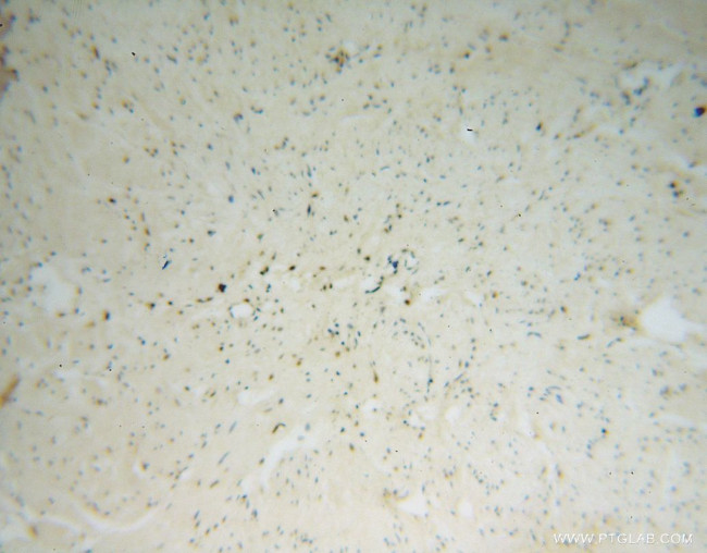 NHP2 Antibody in Immunohistochemistry (Paraffin) (IHC (P))