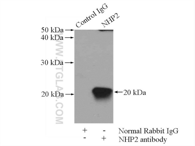 NHP2 Antibody in Immunoprecipitation (IP)