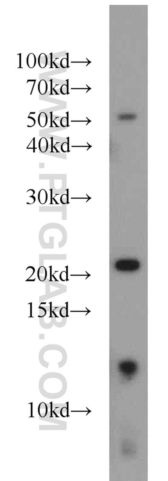 NHP2 Antibody in Western Blot (WB)