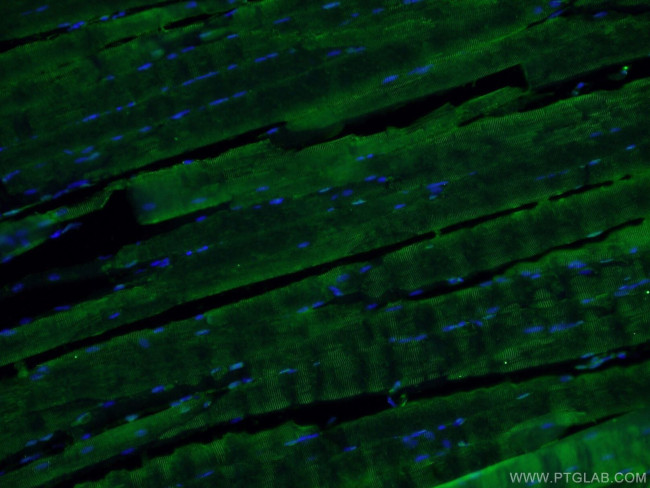 ABLIM1 Antibody in Immunohistochemistry (PFA fixed) (IHC (PFA))