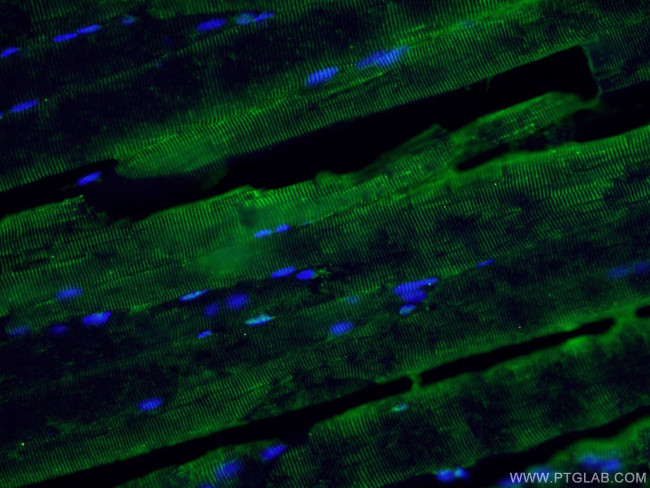 ABLIM1 Antibody in Immunohistochemistry (PFA fixed) (IHC (PFA))