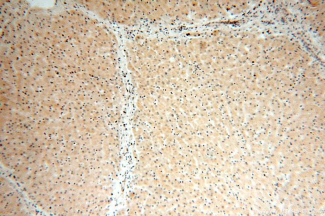 ABLIM1 Antibody in Immunohistochemistry (Paraffin) (IHC (P))