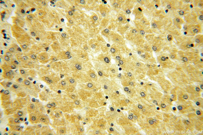 ABLIM1 Antibody in Immunohistochemistry (Paraffin) (IHC (P))