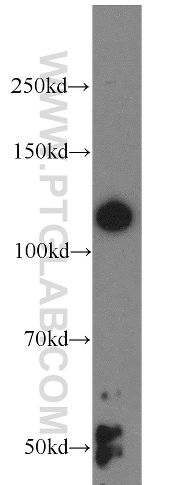 ABLIM1 Antibody in Western Blot (WB)