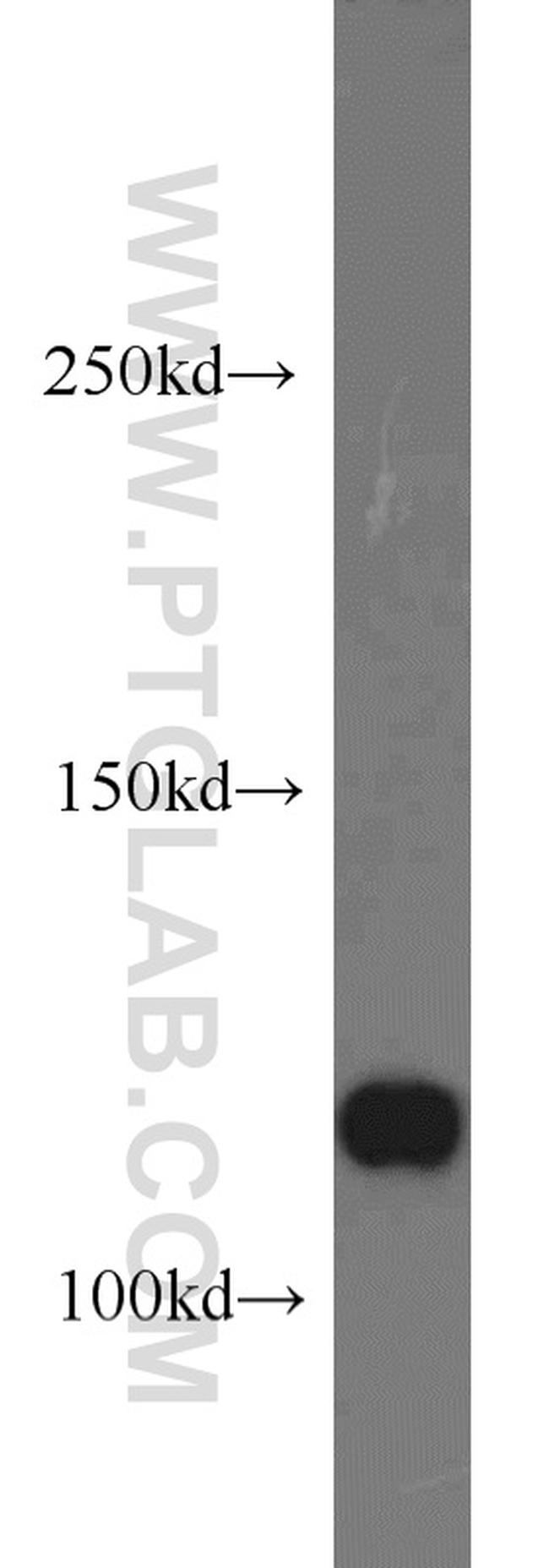 ABLIM1 Antibody in Western Blot (WB)